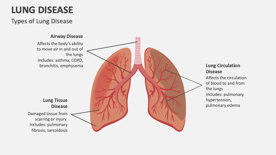 Lung Disease PowerPoint And Google Slides Template PPT Slides
