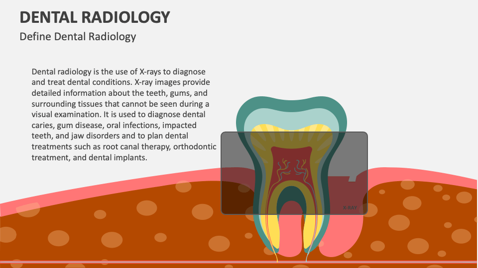 Dental Radiology PowerPoint and Google Slides Template PPT Slides