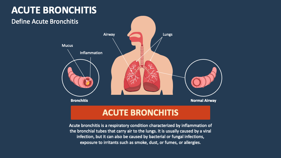 Acute Bronchitis PowerPoint and Google Slides Template PPT Slides