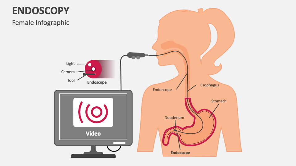 Endoscopy Powerpoint Presentation Slides Ppt Template