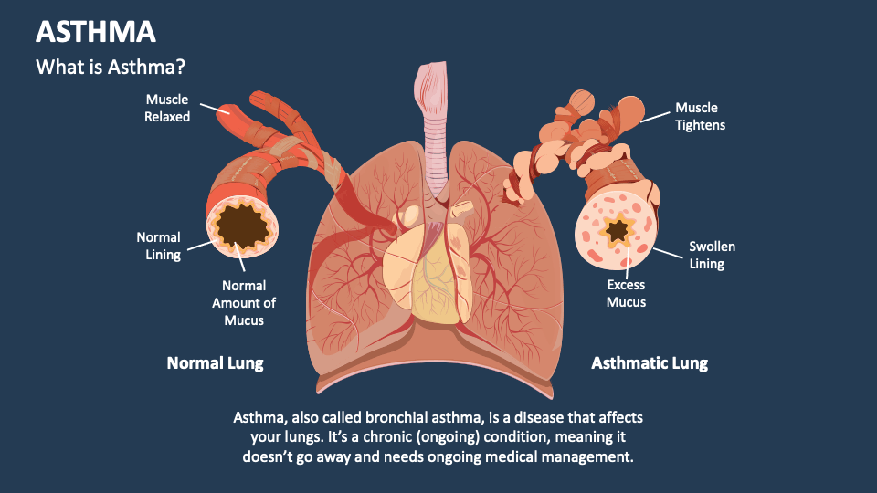 power point presentation on asthma