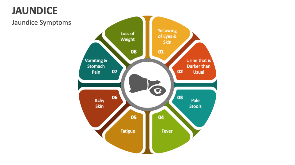 jaundice powerpoint presentation download