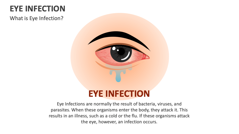 Eye Infection PowerPoint and Google Slides Template - PPT Slides