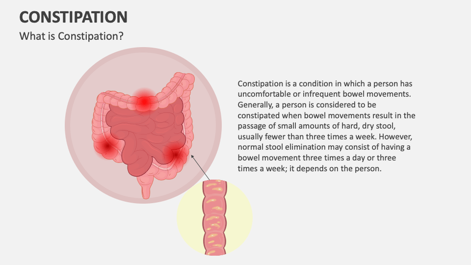 Constipation PowerPoint And Google Slides Template - PPT Slides