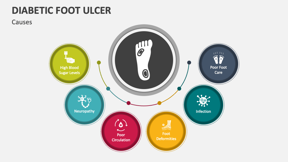 Diabetic Foot Ulcer PowerPoint And Google Slides Template - PPT Slides